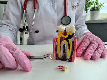 Pediatric Dental Pulp Complications