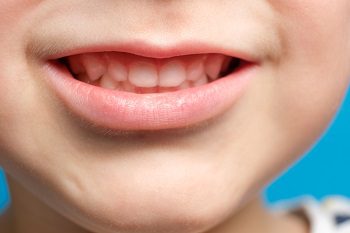 Importance of Fluoride Treatment for Kids