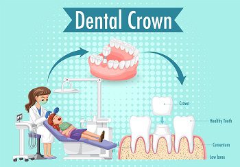 Everything That You Need to Know About Pediatric Crowns