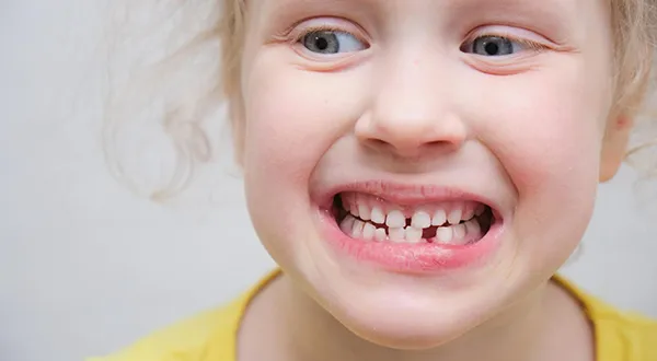 Orthodontic Awareness: Recognizing Signs of Orthodontic Issues in Children
