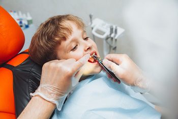 When Does Pediatric Tooth Extraction Become Necessary?