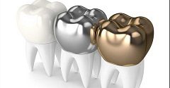 The Differences Between Metal Crowns and Porcelain Crowns
