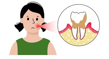Pediatric Dental Emergencies