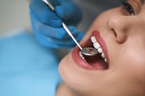 Composite Fillings vs Amalgams 