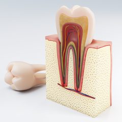 Root Canal Treatment