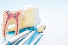 Root Canal Therapy