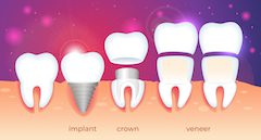 dental crown