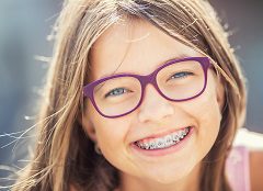 Use of Advanced Braces Technology